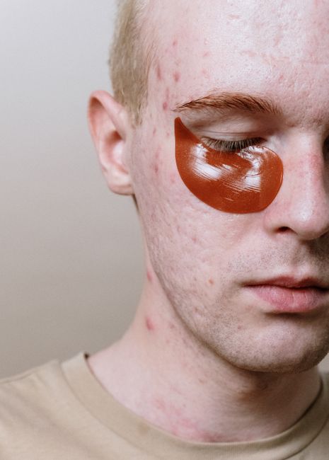 Acne Facial With High Frequency