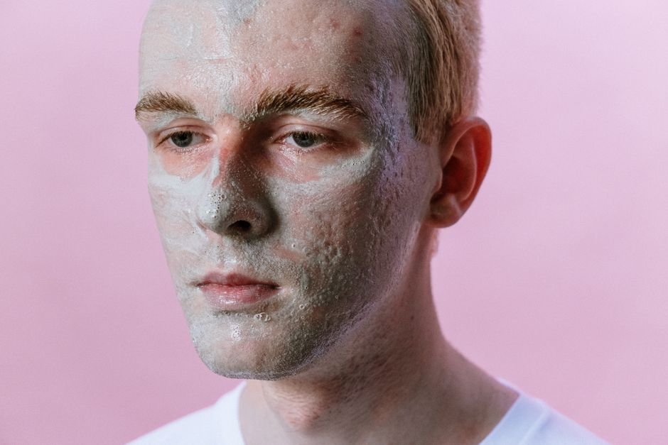 Acne Consultation