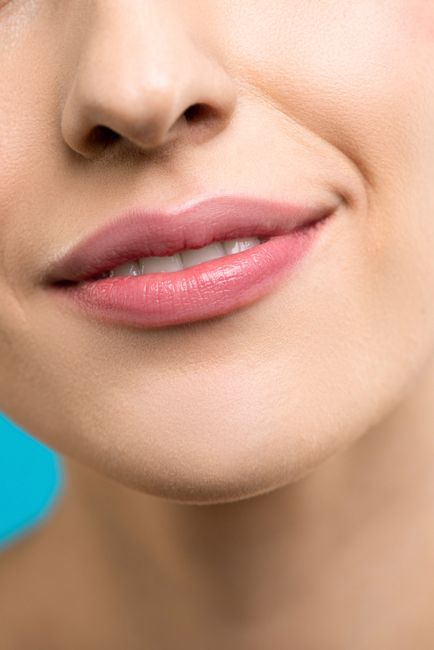 Dermal Fillers service image