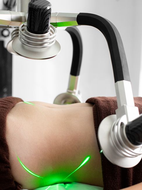 Cellulite Reduction Package – 4 Sessions