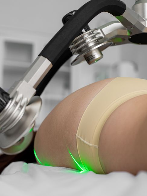 Vermaderm IR Skin Tightening Technology - Large Area