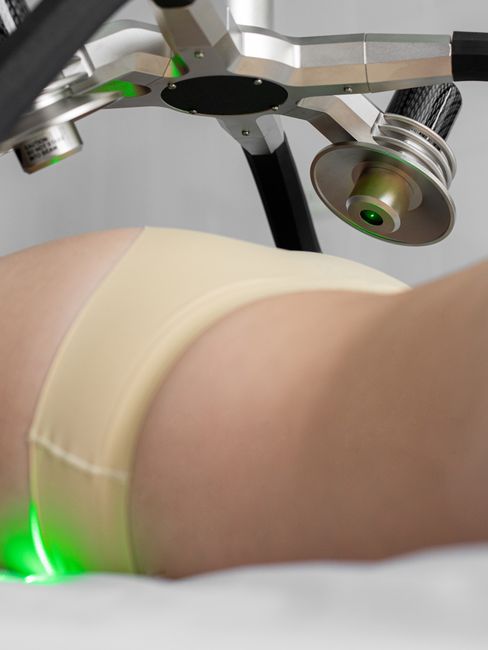 Cellulite Reduction Treatment