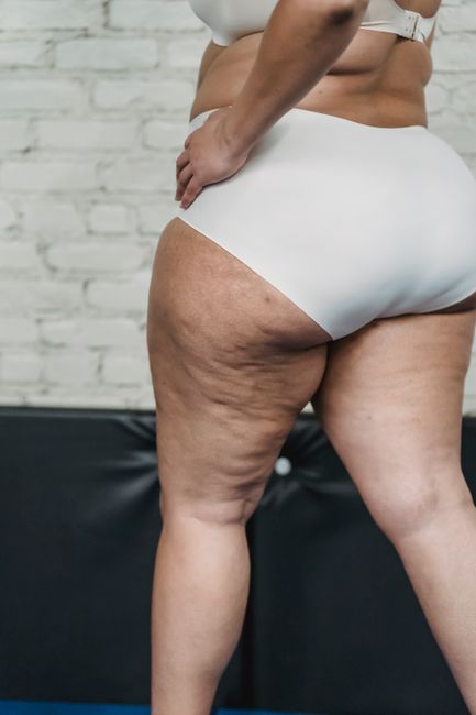 Laser Lipo Fat Reduction