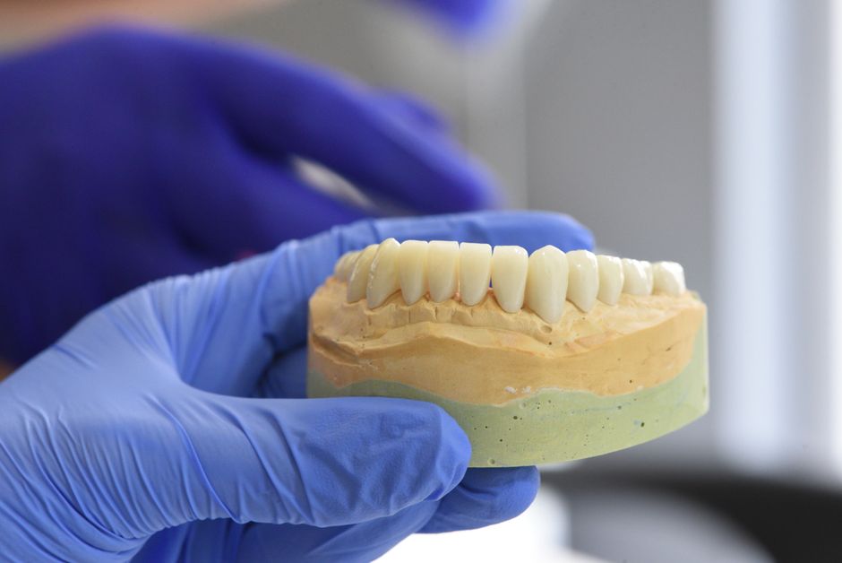 Dental Implants