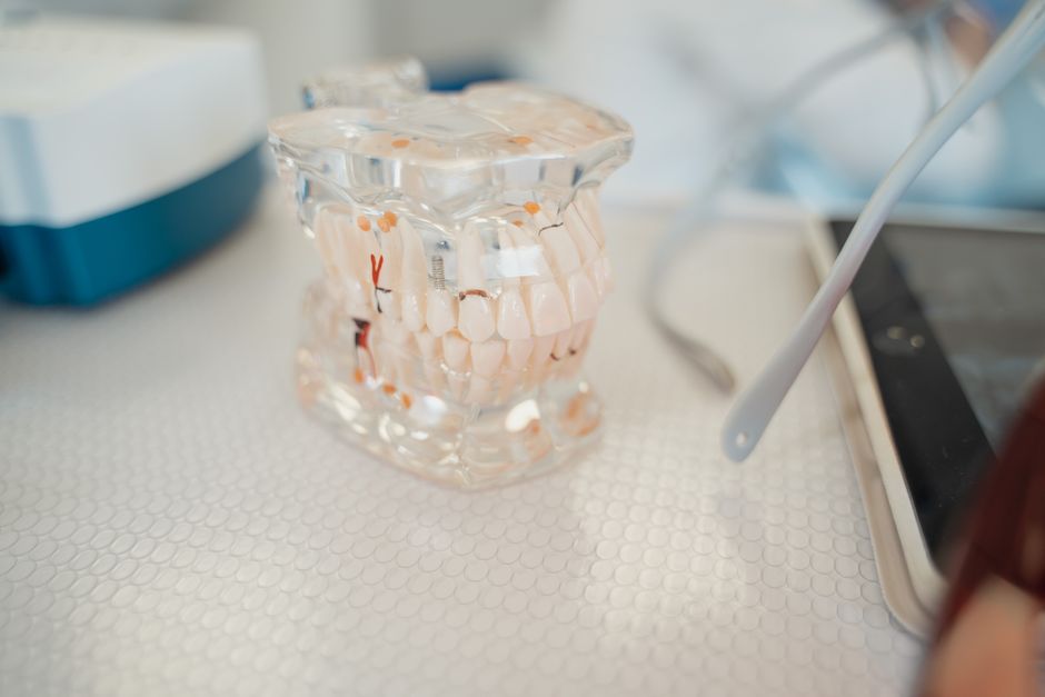 Root Canal Treatment