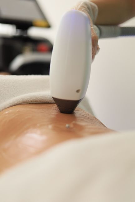 Signature Therapeutic Acupressure - 60 Mins service image