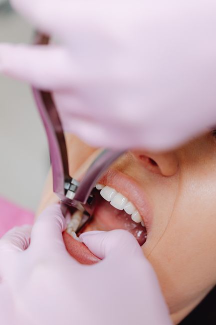 Periodontal Gum Therapy