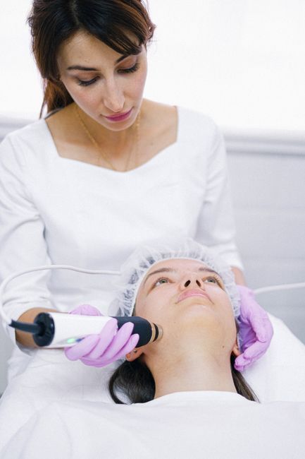 IPL Skin Rejuvenation or Acne Laser Hands