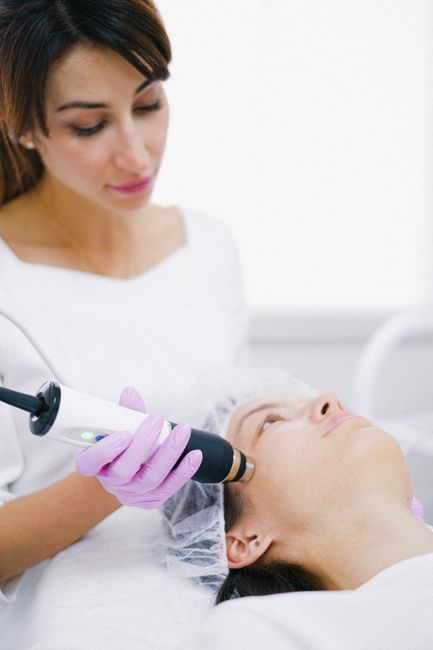 IPL Skin Rejuvenation or Acne Laser Face