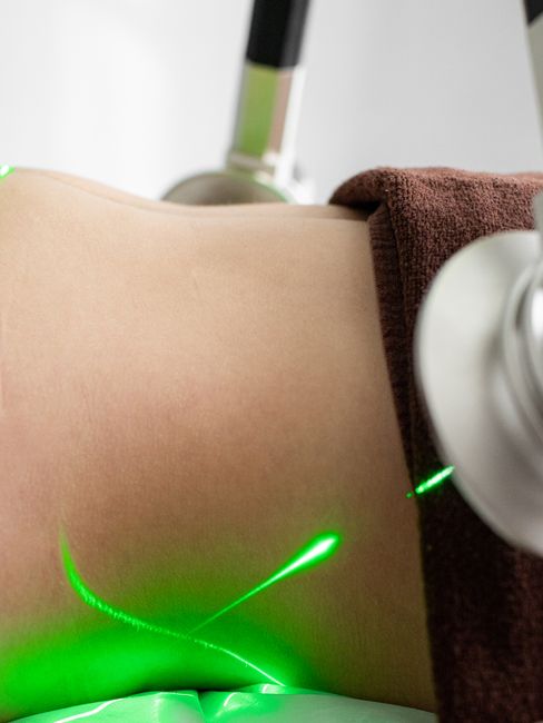 DPC Laser Hair Removal Buttocks