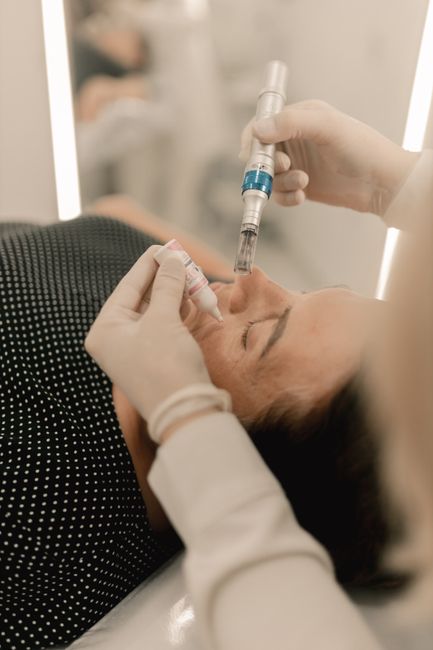 RF Microneedling Morpheus8 - Face and Neck service image