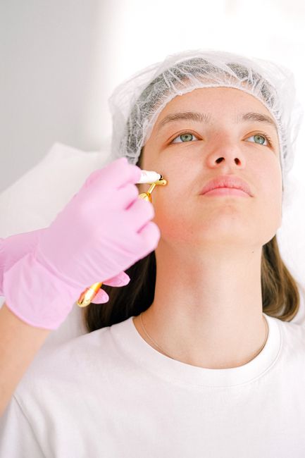 RF Microneedling Morpheus8 - Full Face service image