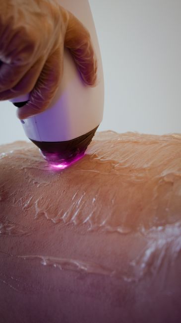 Sugaring Happy Trail