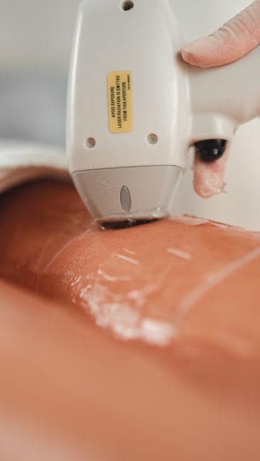 Sugaring Chest