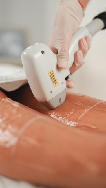Sugaring Underarms