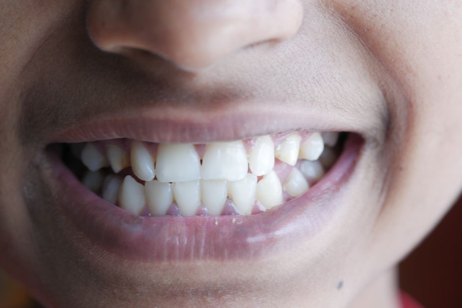 Digital Smile Designing