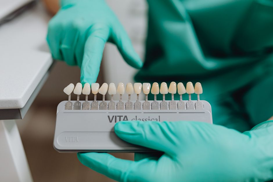 TEETH WHITENING (30 MINUTES)